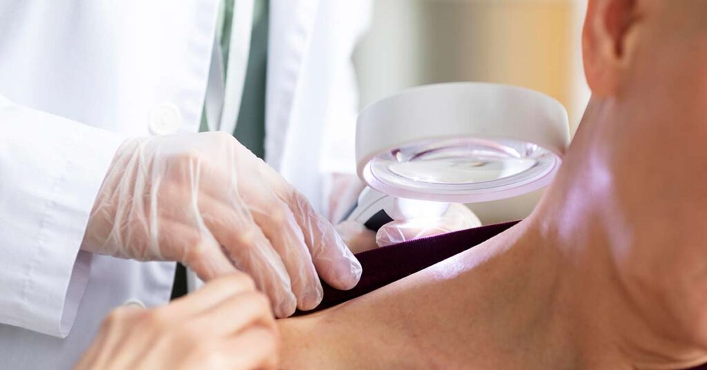 Câncer de pele - quando a radioterapia é a melhor opção