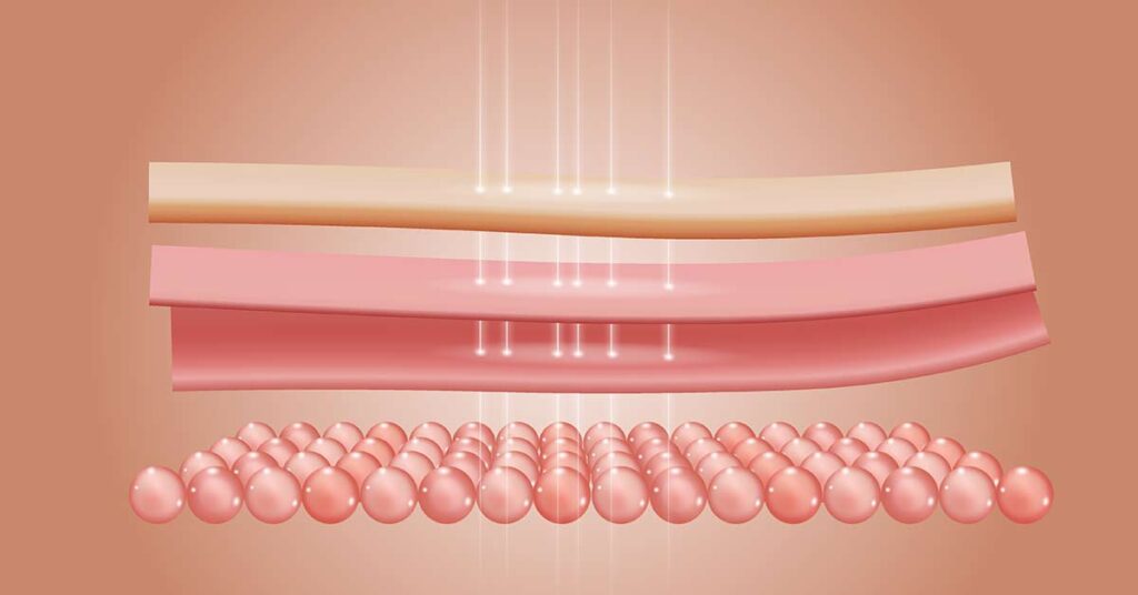 Como a radioterapia afeta a estrutura da pele