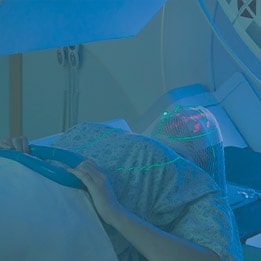 Radioterapia para Tumores de Sistema Nervoso Central