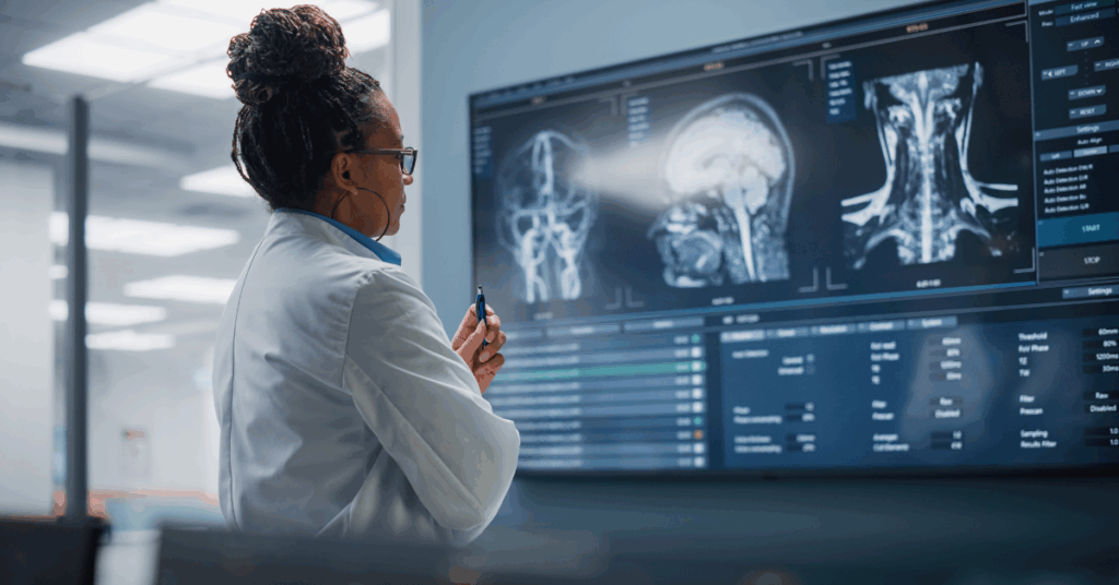 O Impacto da Radioterapia na Longevidade de Pacientes com Tumores Cerebrais