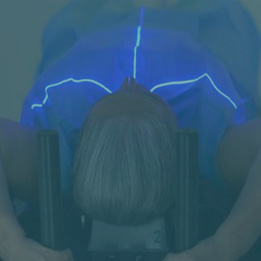 Pulmão: SBRT e Estádio III