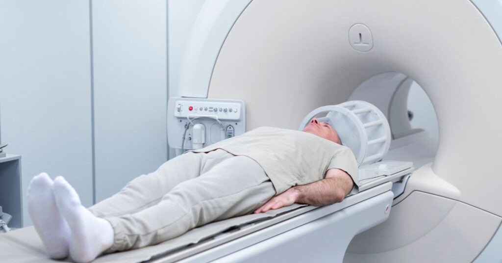 Radioterapia no câncer de pulmão inicial (SBRT): quando é indicada e como funciona