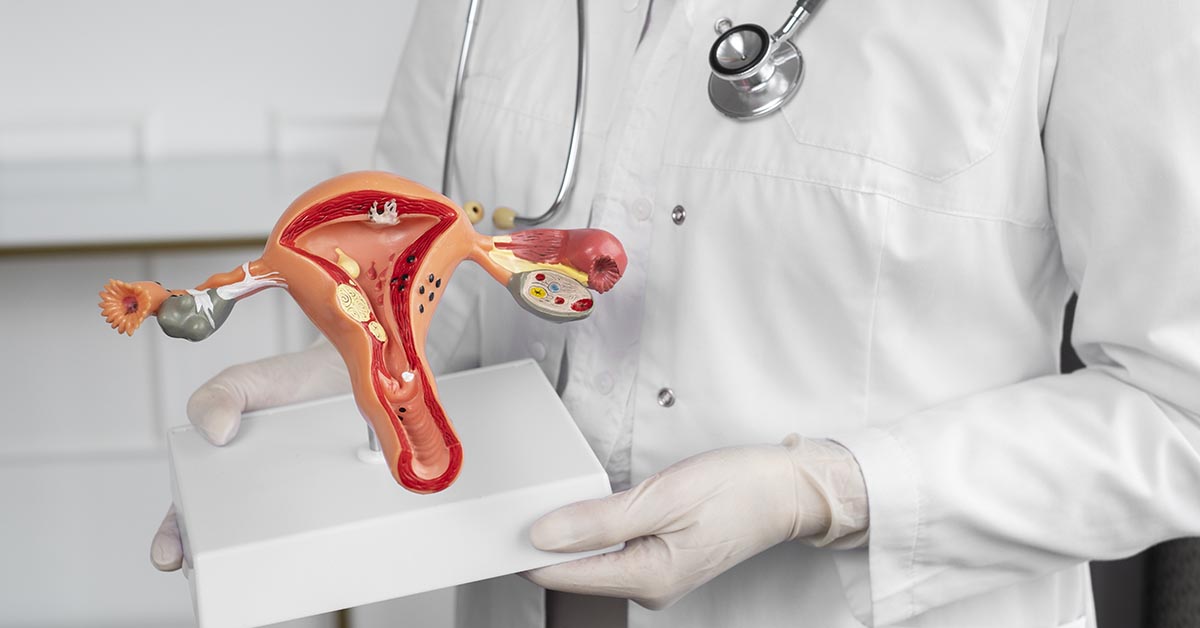 Braquiterapia ginecológica: etapas do tratamento e o que esperar