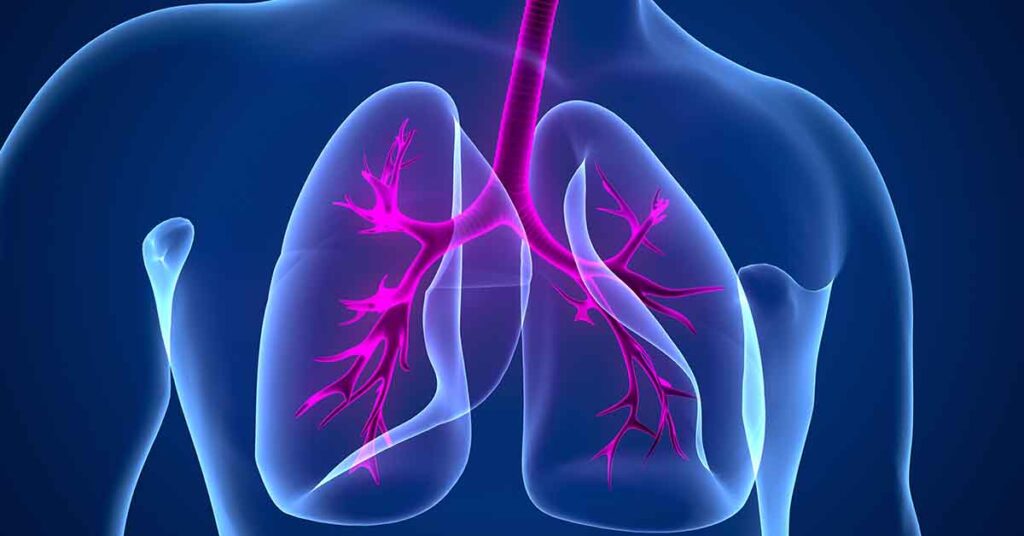 Efeitos da radioterapia no pulmão: o que pode acontecer e como cuidar