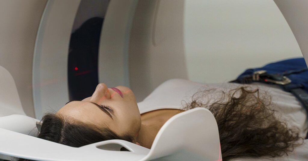 SBRT para câncer de pulmão: o que é e quando é indicada