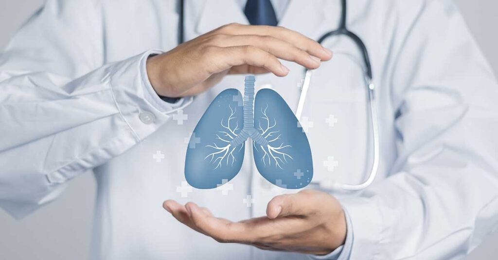 Resultados da SBRT em câncer de pulmão: taxas de controle e sobrevida