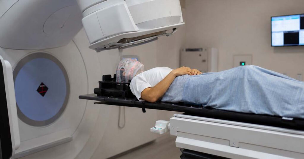 Radiocirurgia estereotáxica para metástases cerebrais: indicações e resultados